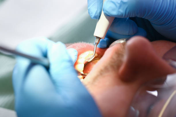 Best Tooth Infection Emergency Dentist  in Leslie, MI