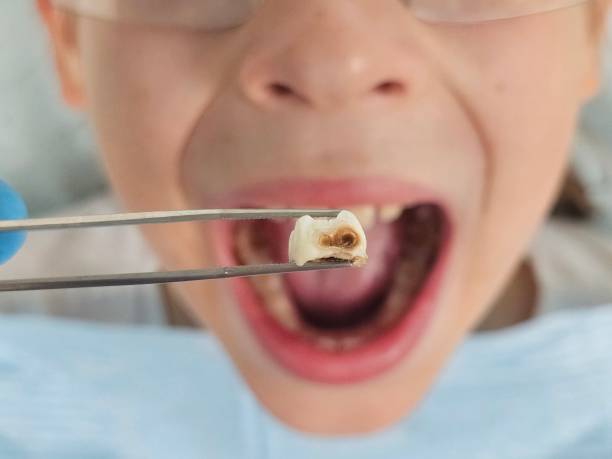 Best Knocked-Out Tooth Emergency  in Leslie, MI